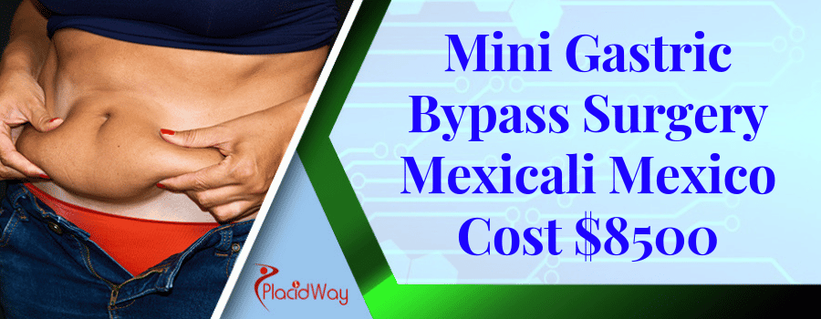 Mini Gastric Bypass Surgery Mexicali Mexico Cost